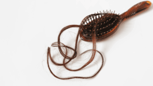 Transplante-capilar-e-autoestima-mais-do-que-estetica-rede-sp-de-noticias